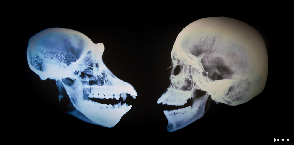 musee-016-2.jpg - Radiographie de crânes